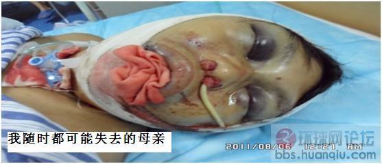 国法苍白无力--暴力拆迁逼母跳楼