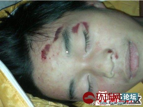 湖北<em>利川市</em>第五高级中学一学生遭老师毒打致死